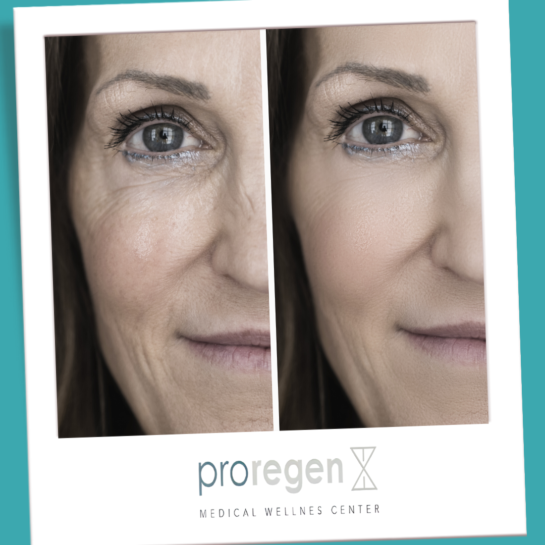www.proregen.com.mx